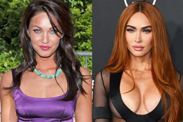 	Did Megan Fox get something else tweaked on her face?	