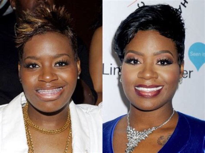 Fantasia Barrino Plastic Surgery: Did The Singer Get Nose Job?