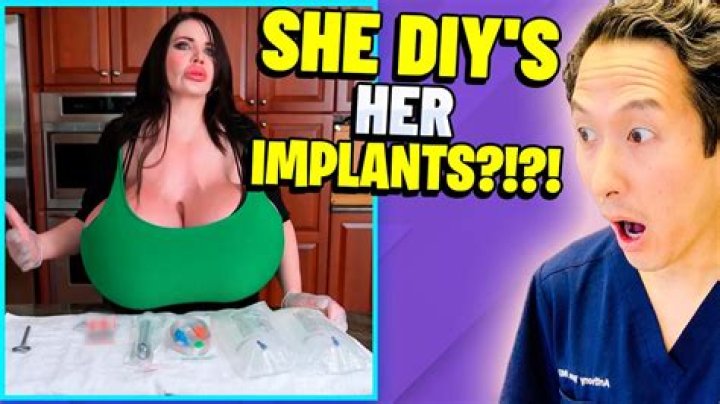 Heidi Montag will have huge problems with her huge implants, doctors say