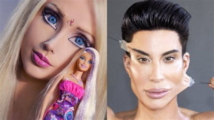 ‘Human Ken Doll’ Rodrigo Alves Came Out As A TransGender; Her Hidden Gender Identity Struggle And Surgeries!