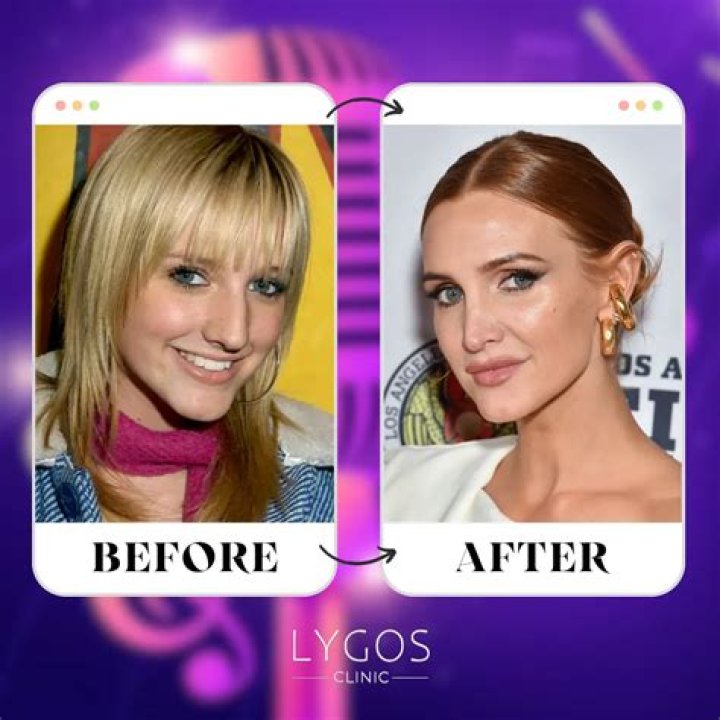 Joe Simpson confirms Ashlee’s nose job