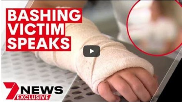 Kirra Heart Beat Up In Attack News – Injuries And Case Details