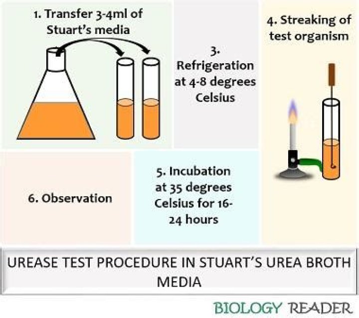 What is a urease test used for?