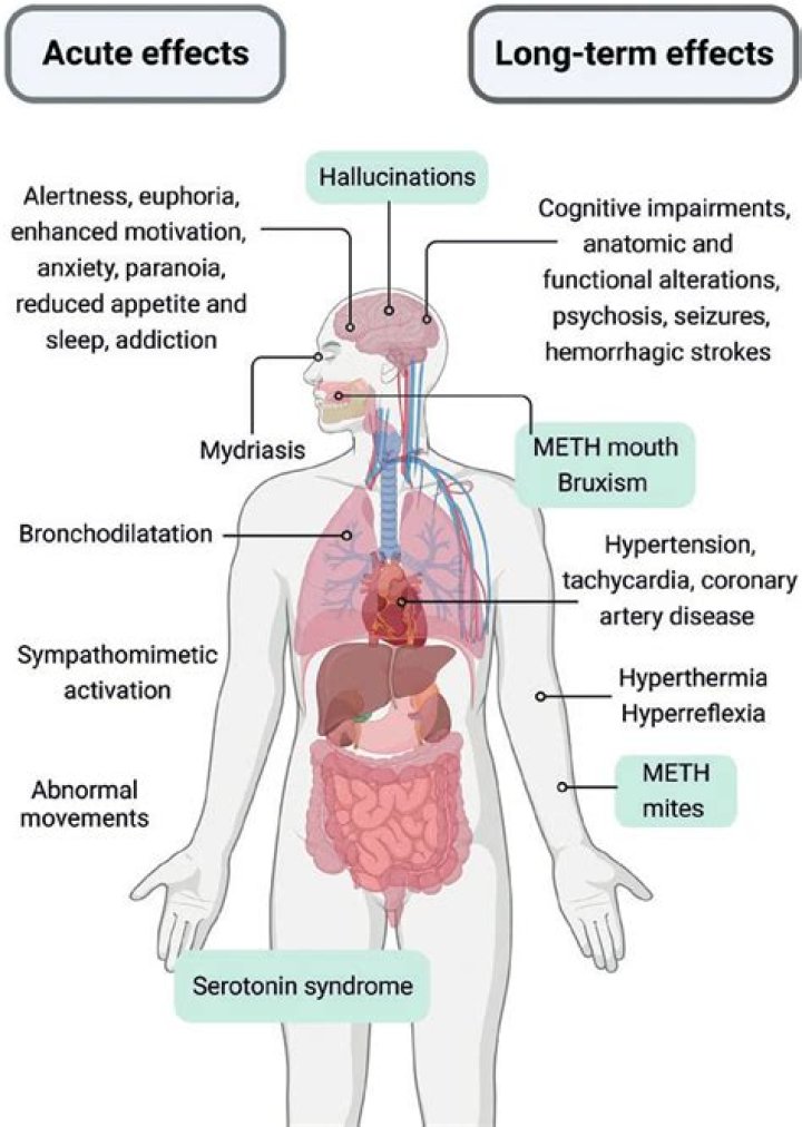 What is the medical term for a type of drug that expands the opening of the passages into the lungs?